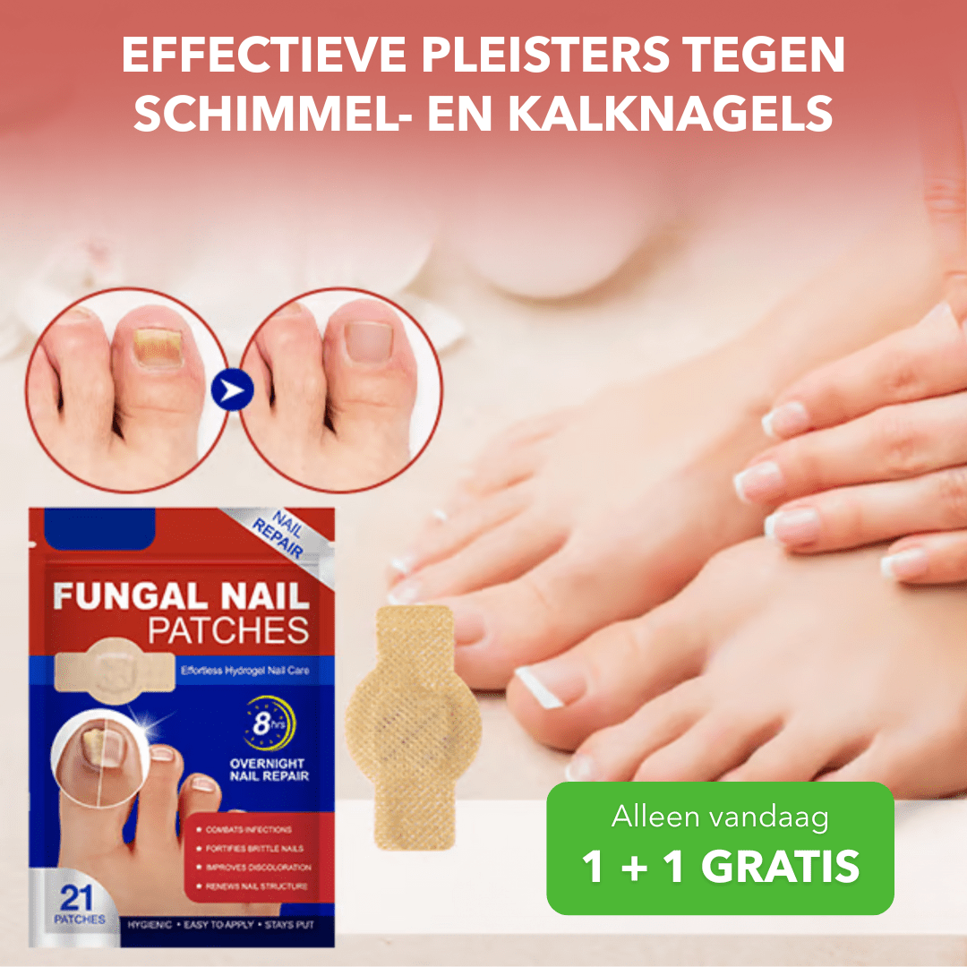 FreshTip™ - Effectieve pleisters tegen schimmel - en kalknagels - Suusie